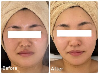 ナビ(NABI)/スーパー小顔