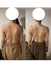 カシェット(cachette)/ブライダルエステ