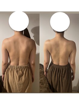 カシェット(cachette)/ブライダルエステ