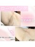 話題のメラニン除去で綺麗なピンク☆脇/肘/膝/他部位＊モニター価格¥99,000～