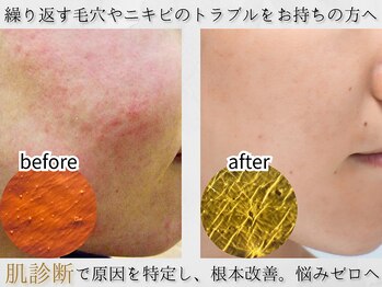 アンレミューラボ(Un Lemieux Labo)