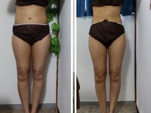 ヴィヴィ(ViVi)/結果だし痩身★ダイエットマシン