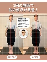 スペックフィジカルコンディショニング(SPECフィジカルコンディショニング)/40代女性/姿勢ビフォーアフター