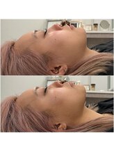 エンルーチェ プラスエイト(en;Luce+8)/脂肪分解レモンボトル