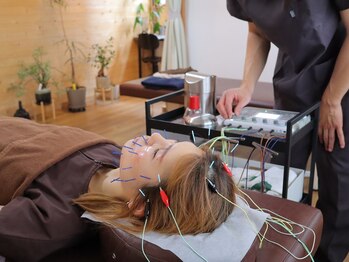 こと鍼灸院・整骨院/頭皮への電気のみ