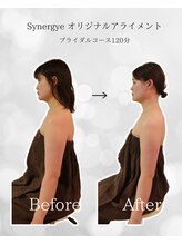シナジェ 並木通り店(Synergye)/ブライダルケア◎痩身スリミング