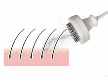 キワミ サーティスリー(kiwami33)/スカルプケアで頭皮ヘッドスパ