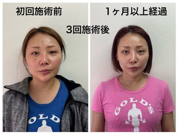 トータルバランス整体院  オレンジ(ORANGE)の写真/のべ10万人を施術！【小顔矯正+顎関節矯正】歴27年以上!リピート率&口コミ◎エラ/頬骨/歪み/左右差を改善!
