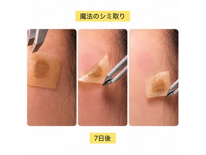 エミュの写真