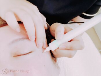 ブラン ネージュ(Blanc Neige)/シミ改善