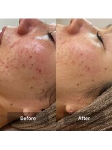 サロン ウイ(salon u'i)/～リブセラ～