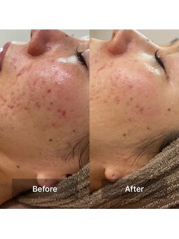 サロン ウイ(salon u'i)/~リブセラ~