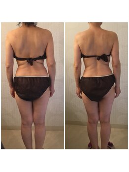 ボディメイクサロン ブリエ(briller)/筋膜1回★バックショットも別人