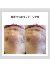 ポムハヌル(pom.haneul)/韓国肌管理室