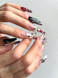スカルプ埋め込み