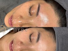 スリー(Three)の雰囲気（フルフェイスWAX脱毛♪産毛や角質除去、顔ダニの予防にも◎）