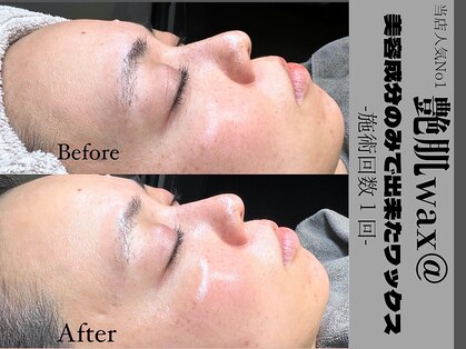 ウイ ネイルアンドビューティー(u'i nail&beauty)の写真