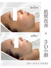 リアム(LiAm)/ララピール×レモンボトル