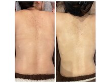 ヴィ レーヴ(Vi Reve)の雰囲気（美容整体・骨盤矯正・小顔矯正・ヘッドスパなど心身共に整えます）