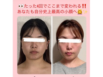 真美(Sinbi)の写真