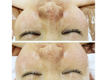 ペリドット(Peridot)/