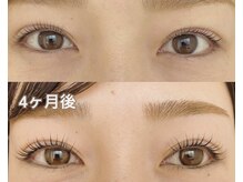 リッツ バイ クレル 北千住本店(RITZ by CLAIR)/エグータム美容液セット