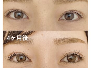 リッツ バイ クレル 北千住本店(RITZ by CLAIR)/エグータム美容液セット