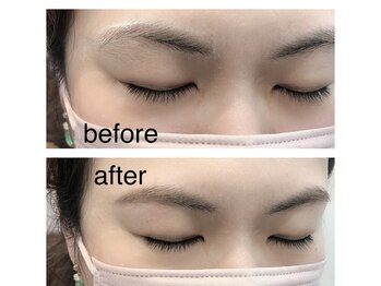 アルター エクラ(aL-ter e´clat)/眉毛WAX脱毛（bdb）