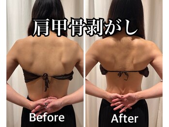 ラウーム 下北沢(lawomb)/肩甲骨剥がし