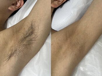 アールビューティー(R Beauty)/見た目もニオイも爽やかに!