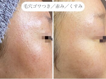 フラックス 京都(FLUX)/【エンビロン】艶肌キープコース