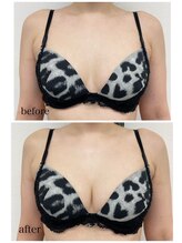 ルミエール(Lumiere)/【倉敷市】バストアップ施術事例