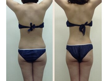 アイル イオン喜連瓜破駅前店/インド式引き締め結果