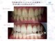 ホワイトニングショップ 守谷店(whitening shop)の写真