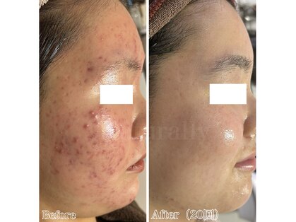 ナチュラリー 佐賀(Naturally)の写真