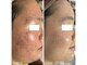 ナチュラリー 佐賀(Naturally)の写真