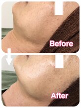 フェイシャルエステ エムズルーム(M's room)/気になる首のたるみ・しわケア