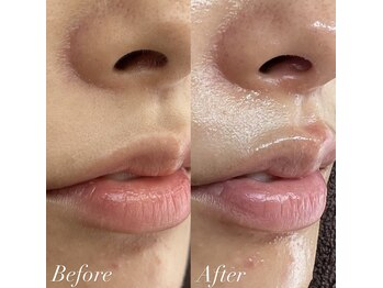 シェリ(Cheri)/フェイスワックス