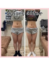 昭和区川名ひまわり接骨院/産後骨盤矯正×ダイエット【3】