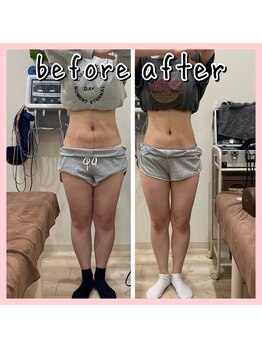 昭和区川名ひまわり接骨院/産後骨盤矯正×ダイエット【3】