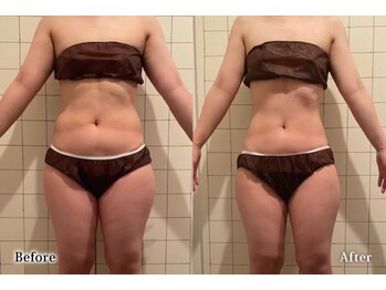 アネル 宮古島店(anel)/