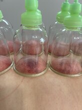 エムエー(ma)/お血反応