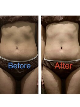 アイル イオン喜連瓜破駅前店/痩身マシン結果