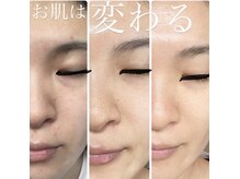 リセリュールサロン 東戸塚(RE:cellulesalon)の雰囲気（オールハンド施術で疲れをすっきり解消！小顔/フェイシャル）