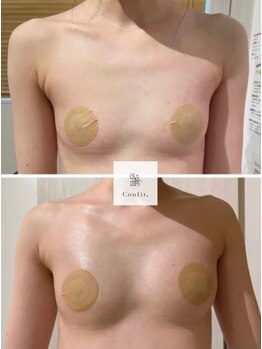コルノ ラッシュアンドビヨンド(Corno Lash&beyond)の写真/【鹿児島初上陸】切らない最新バストUP術!自胸の「脂肪を増やす」特許成分導入で憧れメリハリボディへ