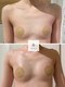 コルノ ラッシュアンドビヨンド(Corno Lash&beyond)の写真/【鹿児島初上陸】切らない最新バストUP術!自胸の「脂肪を増やす」特許成分導入で憧れメリハリボディへ