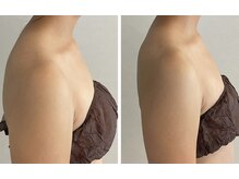 ココノア(COCONOA)の雰囲気(肩こりからくる巻き肩・背中・脇肉・二の腕で見た目年齢が変わる)