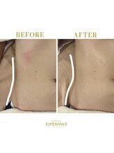 エステティックサロン エスぺランス(ESPERANCE)/ウエスト作りにも！