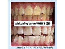 ホワイトニングサロン ホワイト(WHITE)/セルフホワイトニング/大阪/福島