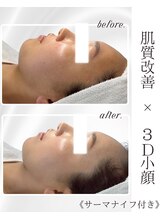 リアム(LiAm)/ララピール×レモンボトル